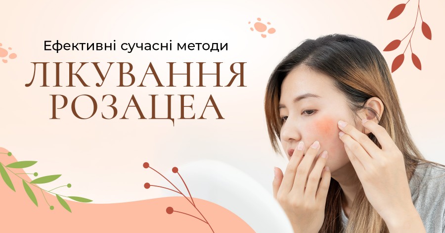 Ефективні сучасні методи лікування розацеа
