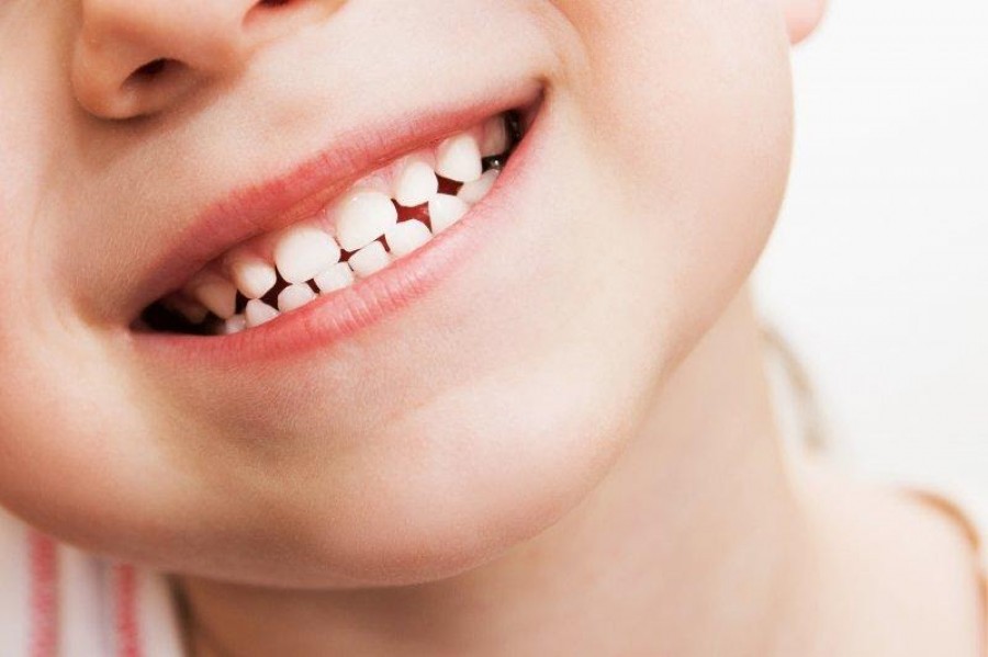 Карієс у дітей: способи профілактики у стоматолога та в домашніх умовах