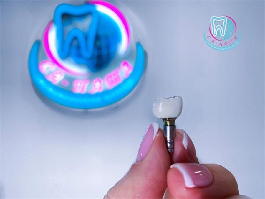 Ринок стоматологічних імплантатів у столиці України